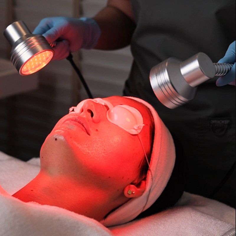 Hydra Facial